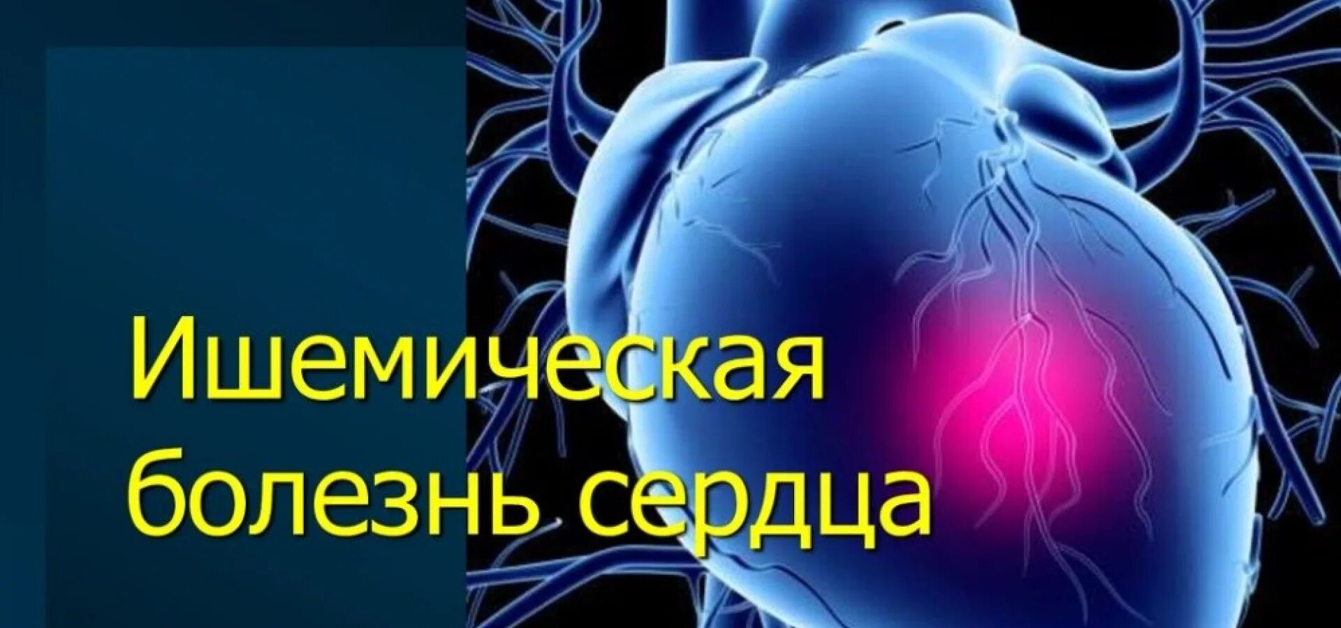 Коронарная ишемия. Ишемическая болезнь сердца (ИБС). Ишемическая болезнь сердца презентация.