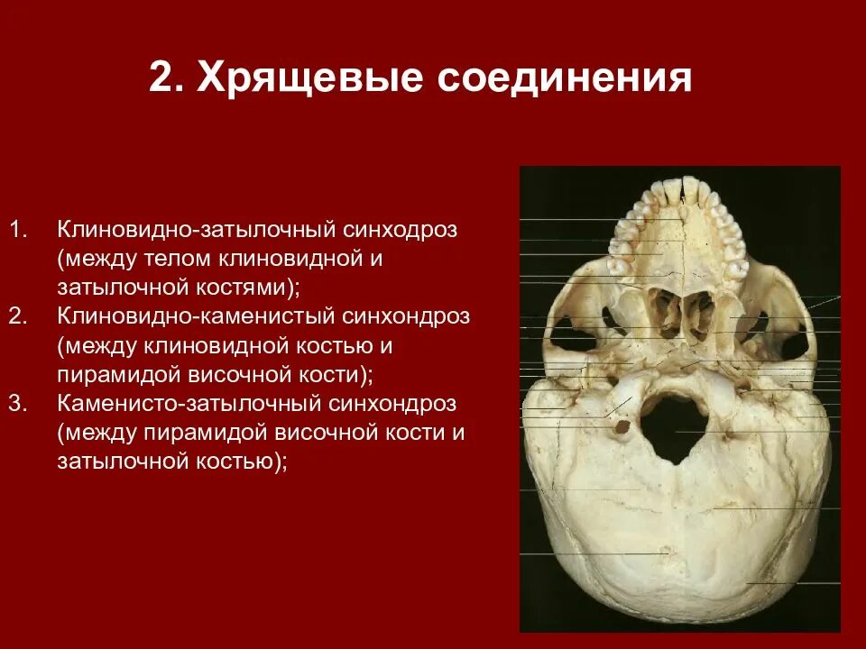 Клиновидно-Каменистый синхондроз на черепе. Синхондрозы черепа анатомия. Затылочная и клиновидная кости черепа соединены.