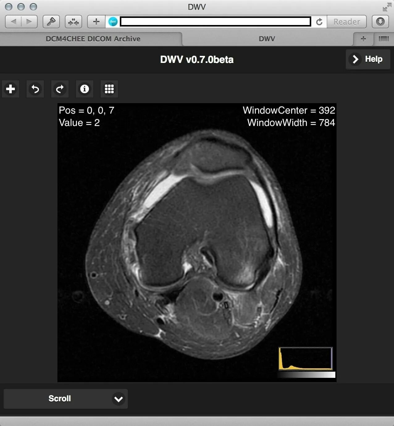Dicom viewer. Dwv (dicom web viewer). dicom файлы мрт. диск формат dicom. dicom изображения для скачивания.