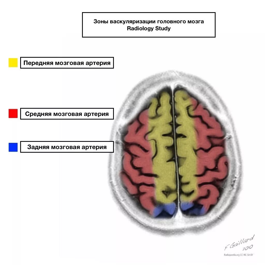Сма мозга. Зоны кровоснабжения мозговых артерий кт. Бассейн передней мозговой артерии. Бассейны кровоснабжения головного мозга. Бассейны кровоснабжения головного мозга схема.