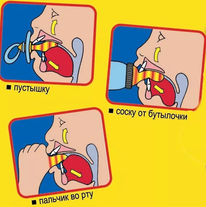 Лучшие сосание. Привычка сосания пальцев. Вредные привычки в формировании прикуса у детей. Последствия сосания пустышки.