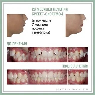 Ортодонт кострома отзывы