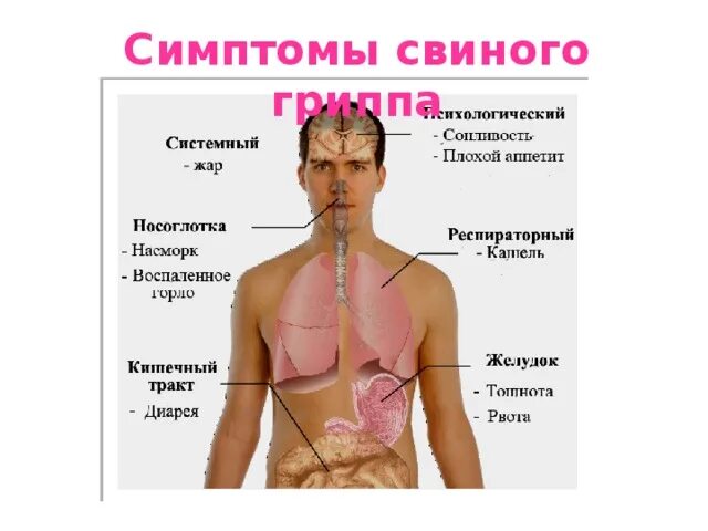 Птичий грипп свиной грипп таблица. Свиной грипп симптомы. Свиной грипп симптомы. Свиной грипп симптомы. Свиной грех.
