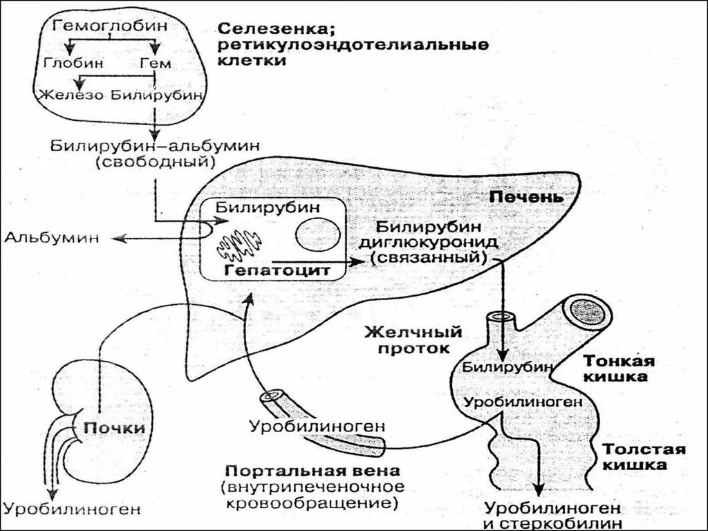 Механическая желтуха схема билирубина. Патогенез механической желтухи биохимия. Механизм образования печеночной желтухи. Механизм развития желтухи биохимия. Распад селезенки