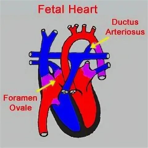 Plexus arteriosus