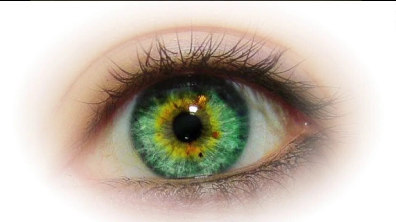Глаза хамелеоны у человека. Центральная гетерохромия хамелеон. Центральная гетерохромия глаз серо зеленые. Гетерохромия зеленый и Карий. Центральная гетерохромия голубых глаз.