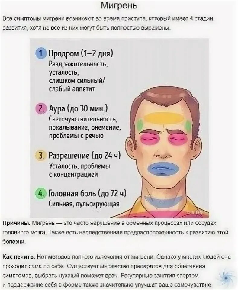 Как снять мигрень в домашних условиях Я вылечила мигрень. если бы я знала это раньше... мигрень
