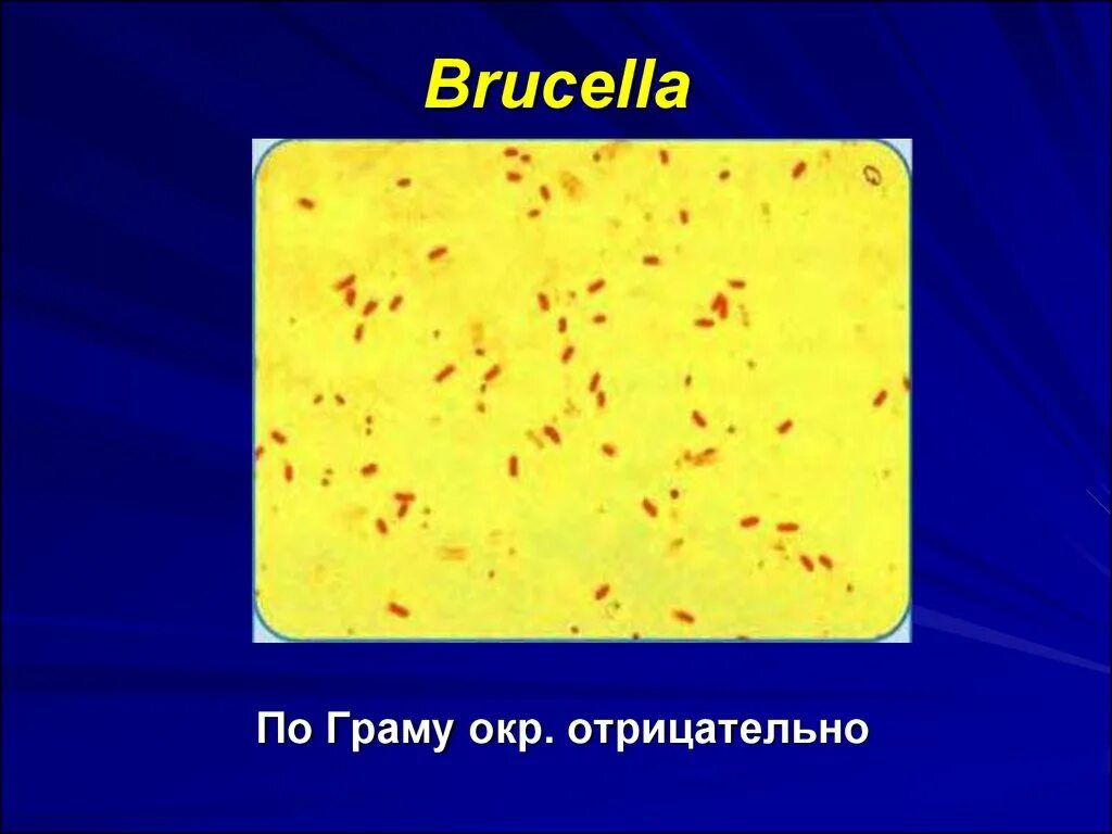 Brucella spp. Бруцелла окраска по граму. brucella abortus окраска по граму. возбудитель бруцеллеза мазок. brucella abortus микроскопия по граму.