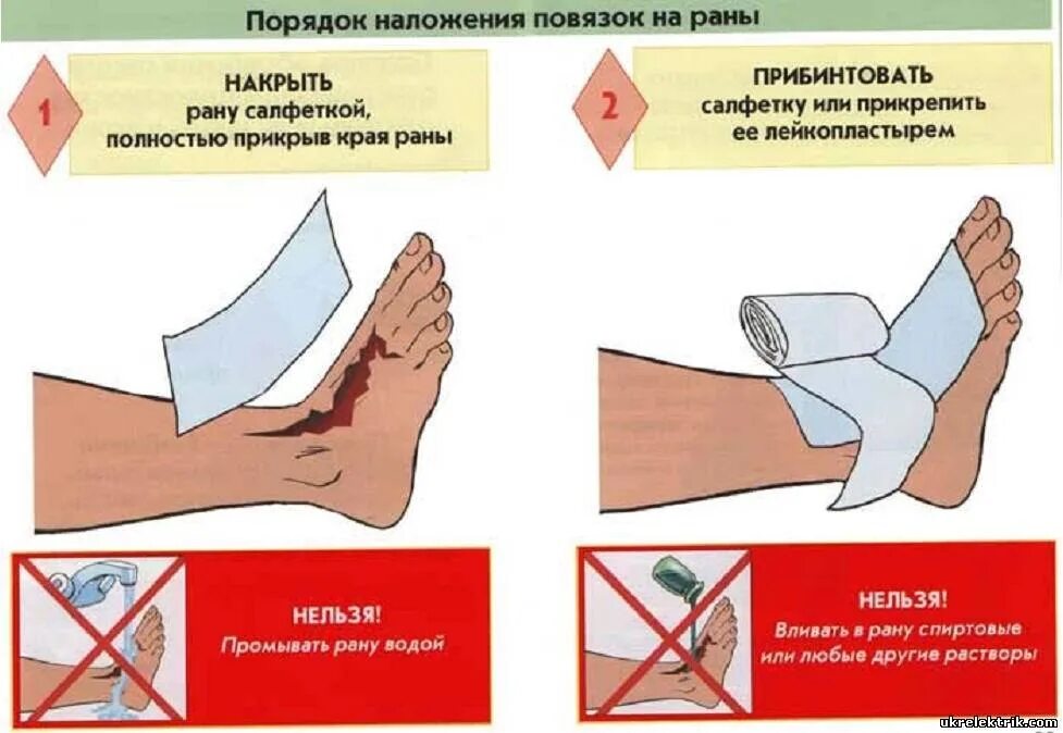 Можно ли открывать рану. Наложение повязок на раны. Правила наложения повязок на раны. Правила наложения повязок на раны конечностей. Как накладывать повязки на раны конечностей