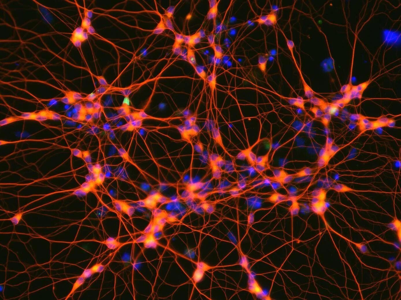 Нейрон клетка головного мозга. Нервная система человека Нейрон. Нейронная система мозга. Нейронная сеть головного мозга человека. Иммунные клетки мозга