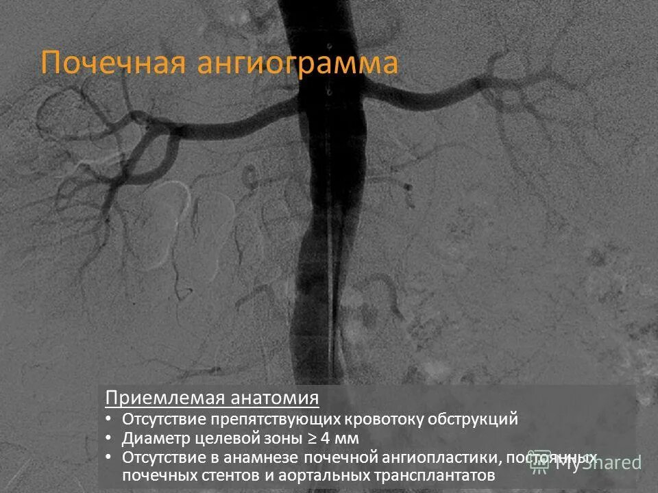 Ангиодистония сосудов. Почечная ангиография техника.