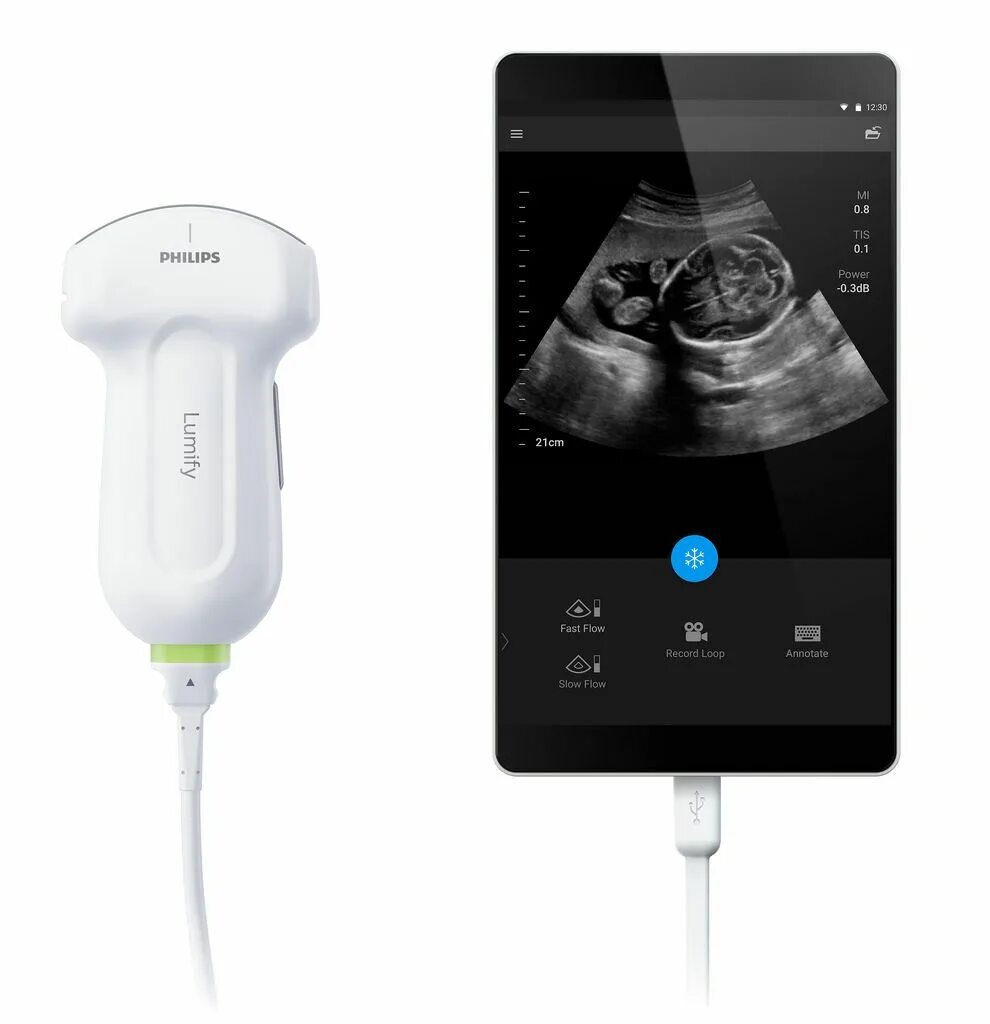 Philips Lumify УЗИ. Портативный УЗИ аппарат Philips Lumify. Система ультразвуковая портативная Lumify. Портативные датчики УЗИ Филипс. Филипс ультразвуковая