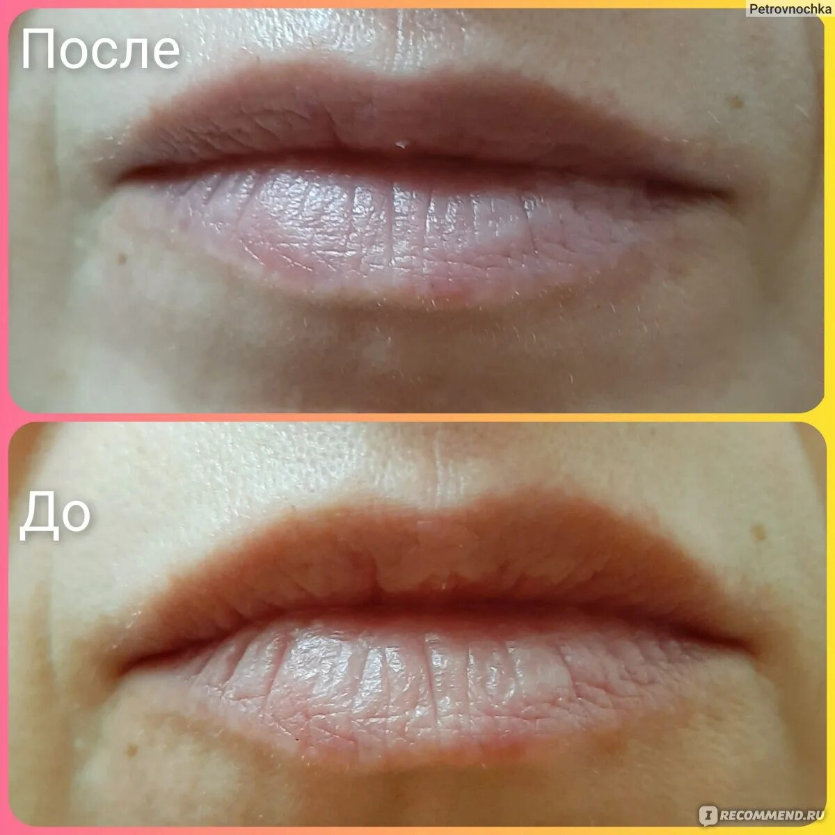 Zozu lip mask
