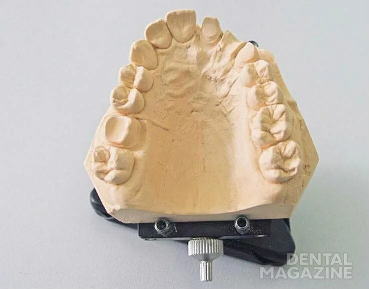 Отливка гипсовых моделей. Модель из гипса. Рабочая гипсовая модель. Скульптуры из гипса. Модель из гипса.