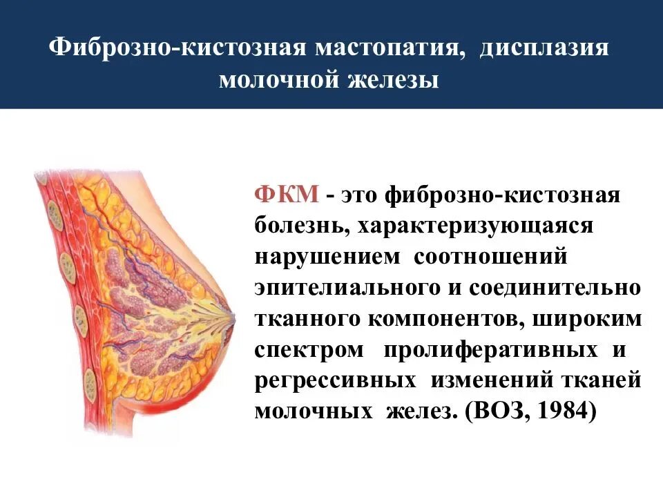 Молочных желез фиброзный. Молочных желез фиброзный