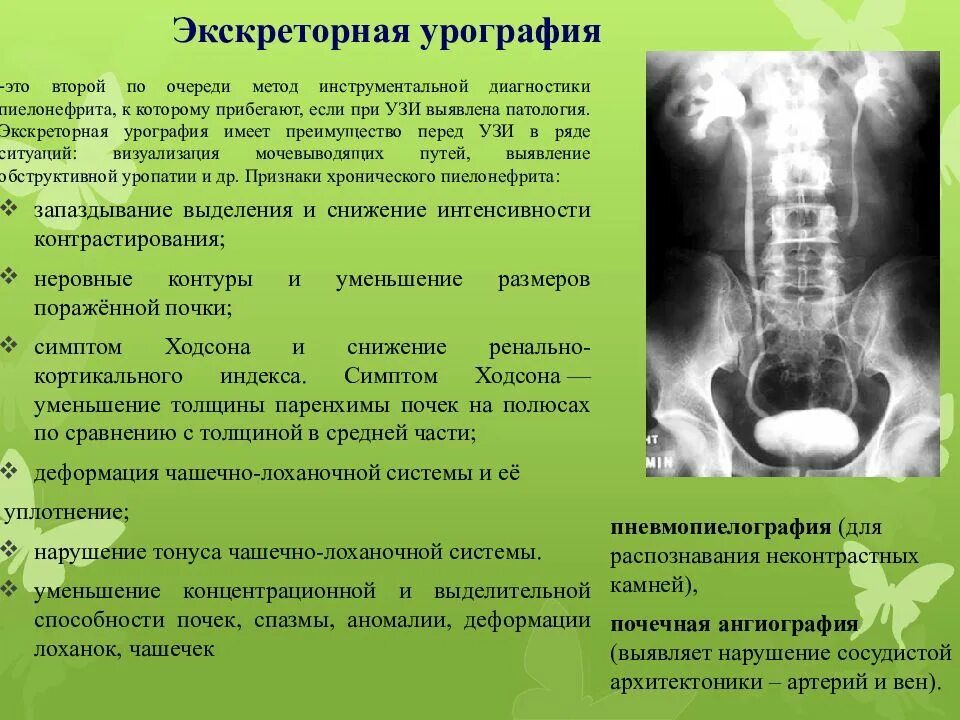 Исследования при пиелонефрите. Экскреторная урография рентген описание. Показания для экскреторной урографии у детей. Экскреторная урография при хроническом пиелонефрите. Экскреторная урография почек рентген.