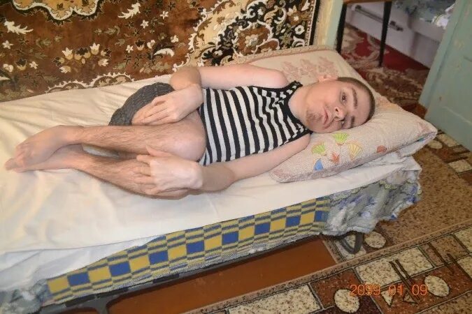 Взрослые люди с дцп. Больной дцп. дети больные дцп. дцп у взрослых людей.