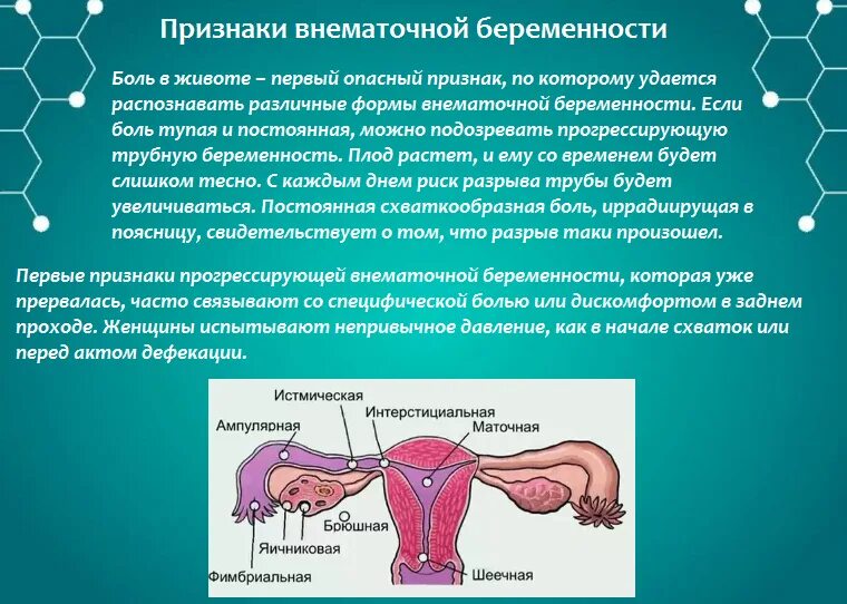 Внематочная беременность это симптомы