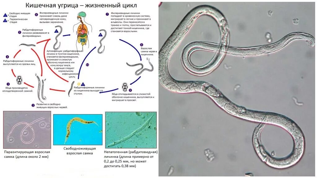 Жизненный цикл угрицы кишечной схема. Strongyloides stercoralis цикл. Strongyloides stercoralis жизненный цикл. Угрица кишечная strongyloides stercoralis.