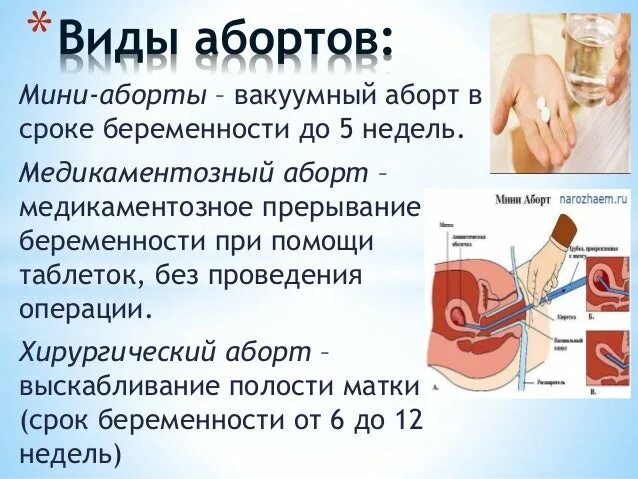 Во сколько можно делать аборт. Сколько стоит сделать аборт. Сколько стоит аборты врачом. Где в Павловской можно платно сделать аборт