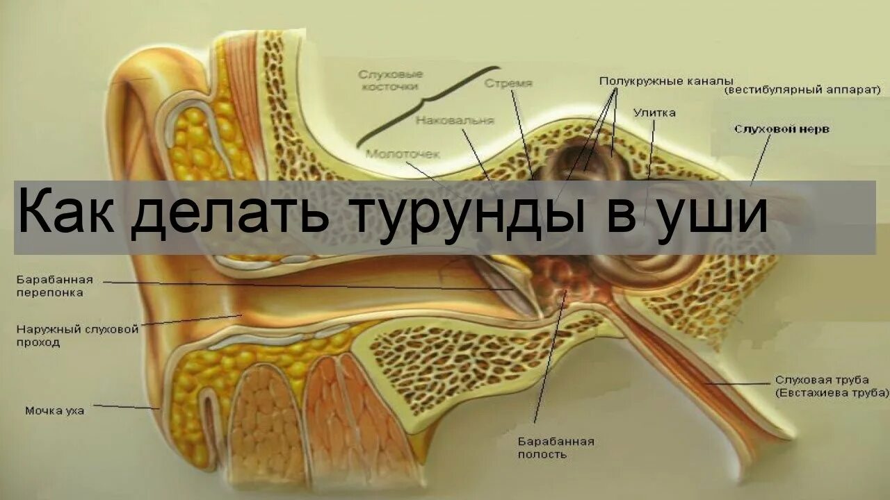 Как делать турунды. Как сделать турунды в уши. Как правильно делать турунды в ухо.