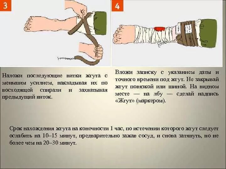 Максимальное нахождение жгута на конечности. Записка с временем наложения жгута. Максимальное время нахождения жгута на конечности.