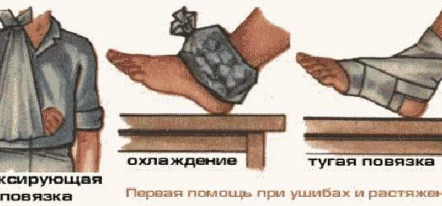 Первая помощь при растяжении связок. ПМП при ушибах вывихах и переломах. ПМП при ушибах растяжение связок вывихи. ПМП при переломах и вывихах растяжениях ушибах. Ушибы растяжения вывихи переломы ПМП.