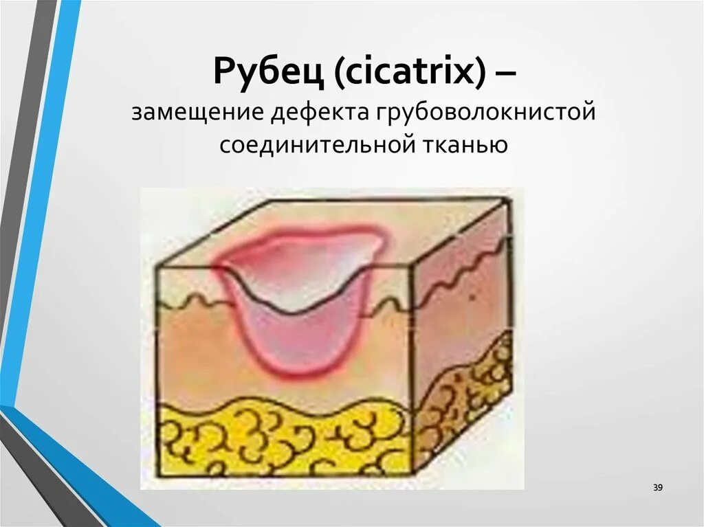 Вторичные морфологические элементы кожи рубец. Морфологический элемент рубец на коже. Слизистая рубца