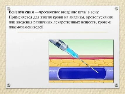 Подкожно попал воздух