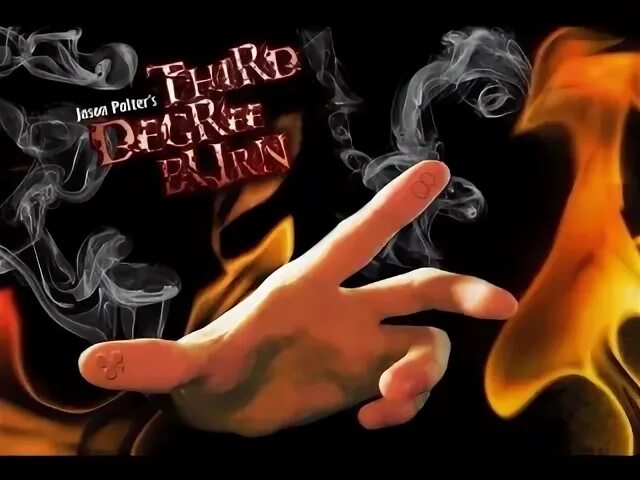 Burning in the third. Burning in the third. Евгений фейер фотограф. Burns first aid. Огонь.