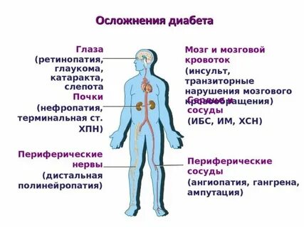 Острый диабет