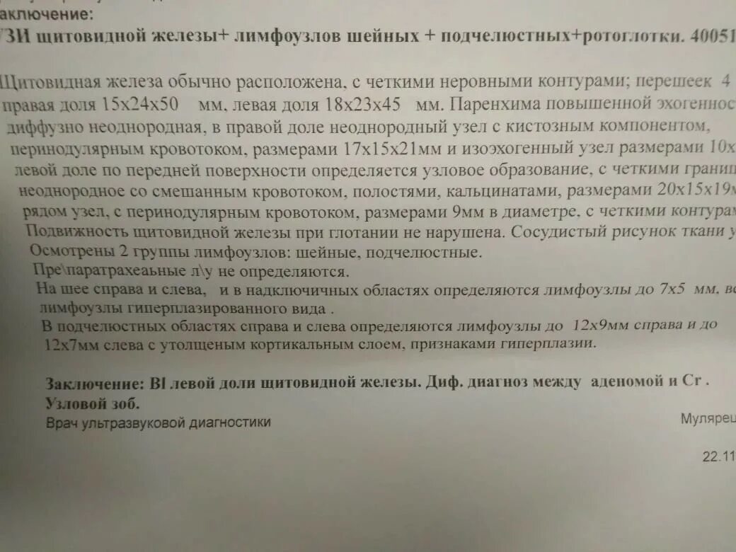 Узловое образование правой доли щитовидной. Аплазия левой доли щитовидной железы. Образование левой доли щитовидной железы у женщин. Гиперплазия левой доли щитовидной железы СКТ.