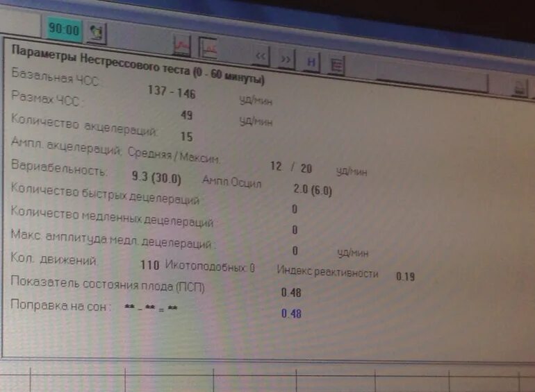 Индекс реактивности ктг норма. Показатель состояния плода. Псп 0,51 ктг в пределах нормы. 23 ктг. 01.