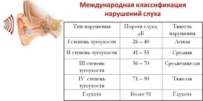 Слабослышащие степени. Нейросенсорная тугоухость классификация степень. Кондуктивная тугоухость классификация. Степени нейросенсорной тугоухости таблица. Тугоухость степень нарушения слуха.