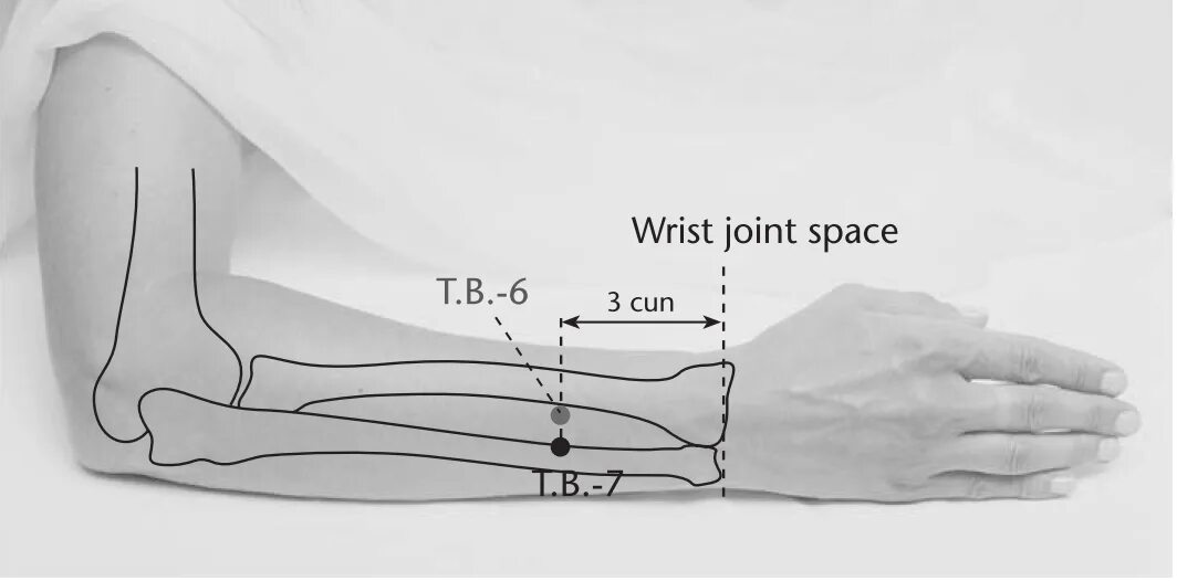 Точка tr5 вай-Гуань. Tr6 точка акупунктуры Джи гоу. Хуэй-Цзун точка. Tr7 точка акупунктура. Кис точка
