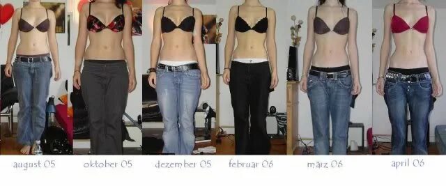 Рост 170 в 15. Рост и вес анорексичек. Рост и вес при анорексии.