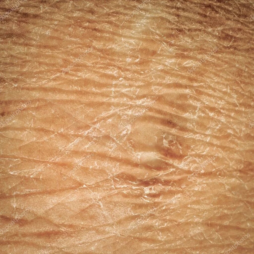 Очень сушится кожа. Очень сушится кожа. Обезвоженная кожа тела. Сухая пергаментная кожа. Очень сушится кожа.