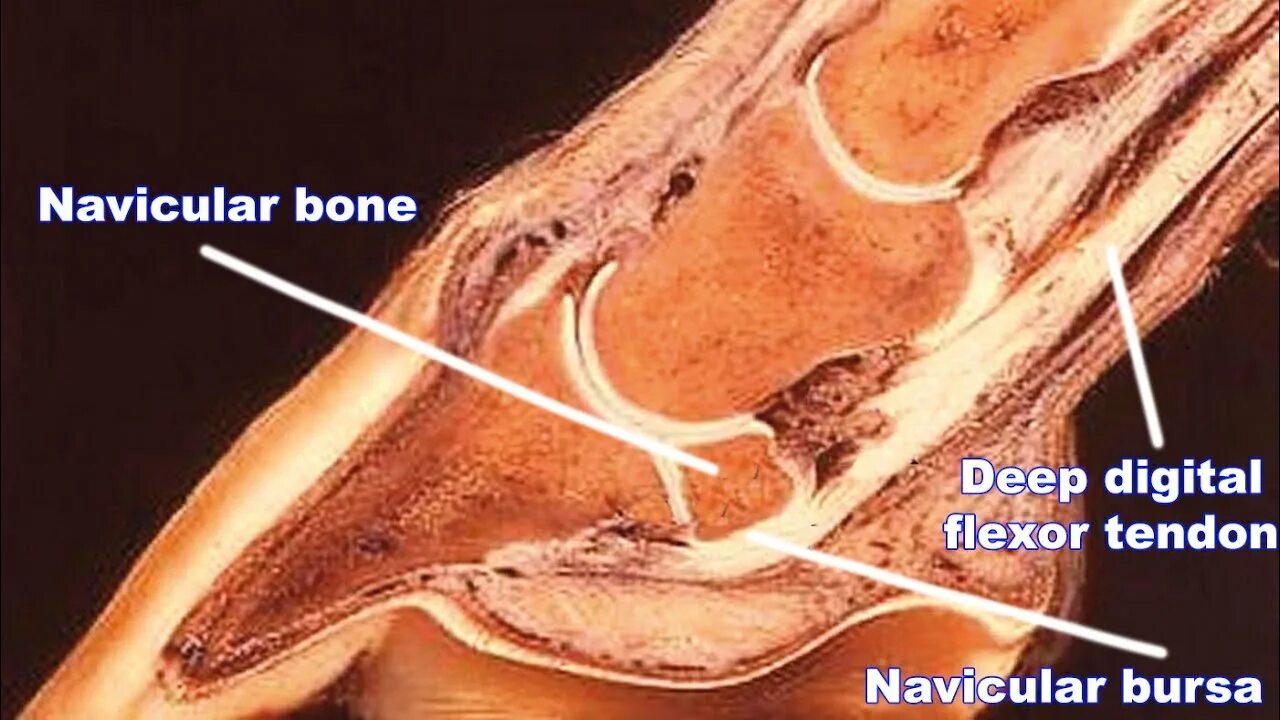 Deepest bone. Navicular bone. horse bones. navicular locking plate.