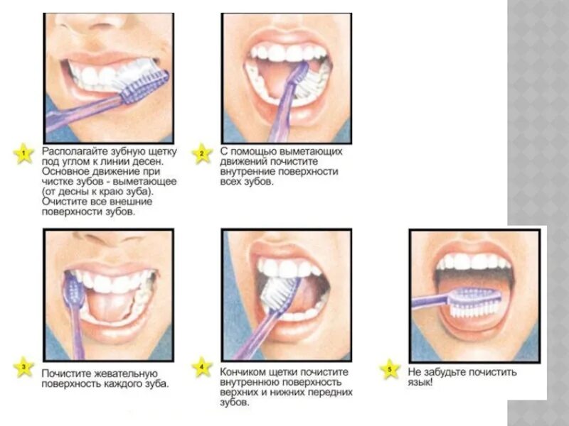 Техника чистки зубов. Правильная техника чистки зубов. Как правильно чистить зубы. Неправильная техника чистки зубов.