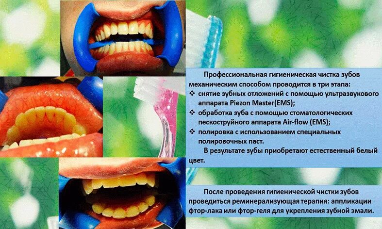 Что входит в профессиональную чистку