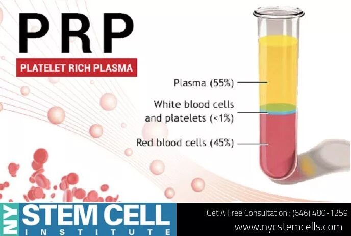 Плазмотерапия сустав prp. Мышечное волокно состоит из миофибрилл. Плазмотерапия сустав prp. Плазма мышц. Плазма мышц.
