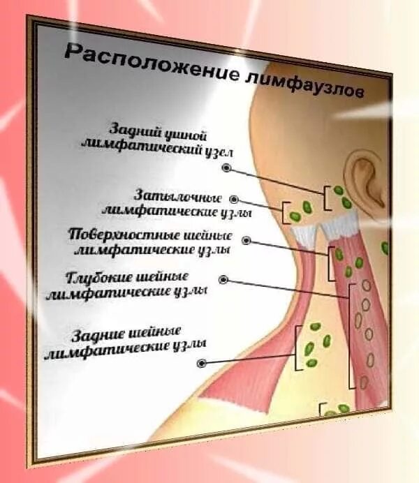 Как лечить лимфоузлы узлы Картинки АНТИБИОТИК ПРИ УВЕЛИЧЕНИИ ЛИМФОУЗЛОВ