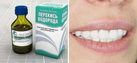Полоскают ли рот перекисью