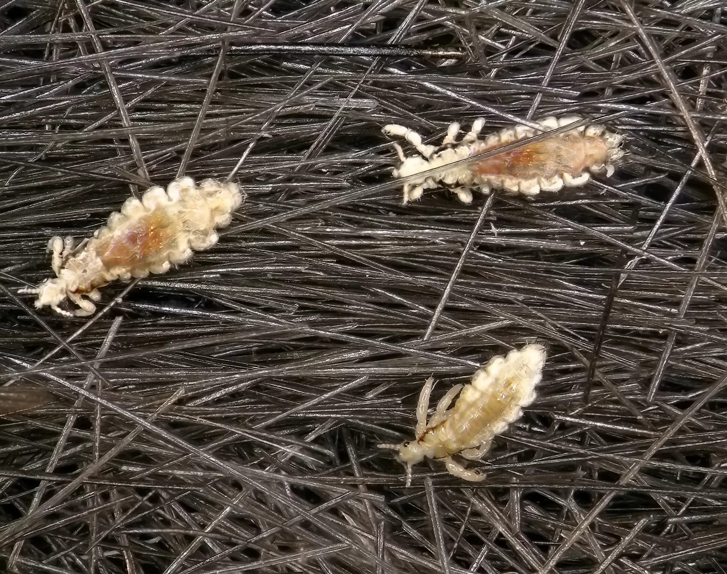 Головная вошь (Pediculus humanus capitis). Гнида головной вши