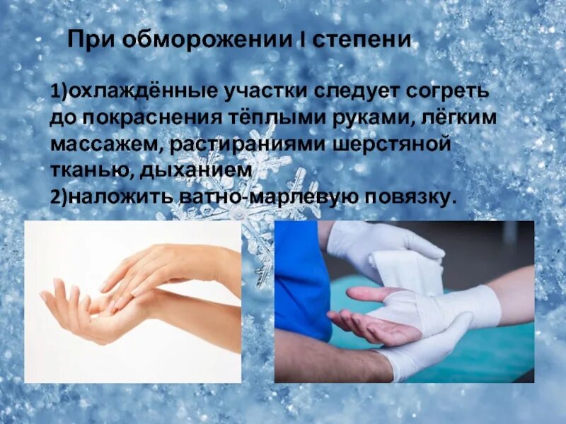 Обморожение классификация