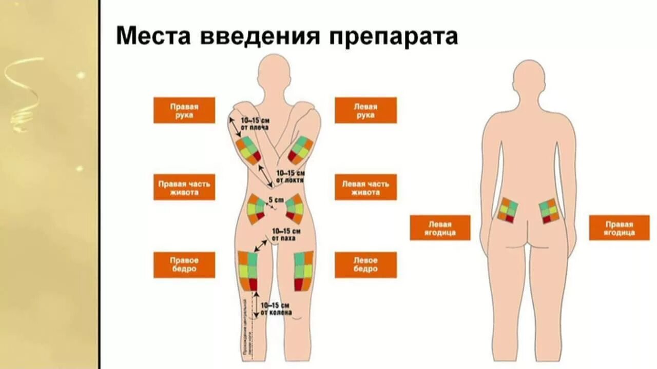 Куда колоть длинный инсулин. Места для уколов инсулина. Места для инъекции инсулина схема. Места инъекций инсулина. Схема короткого и длинного инсулина.
