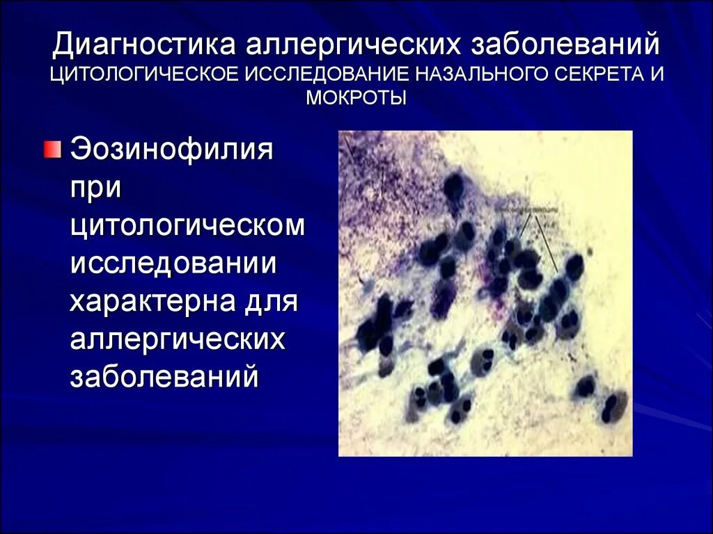 Мокрота при аллергии. Цитологическое исследование. Цитологическое исследование методика. Цитологический диагноз. Методы гистологических и цитологических исследований.