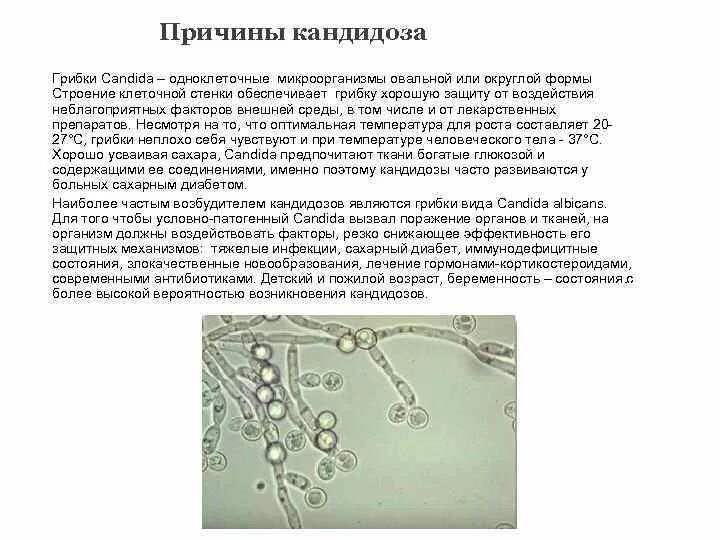 Дрожжеподобные грибы рода candida. Дрожжеподобные грибки рода candida. Дрожжеподобный грибок кандида. Дрожжеподобный гриб рода candida. Колонии кандида альбиканс.
