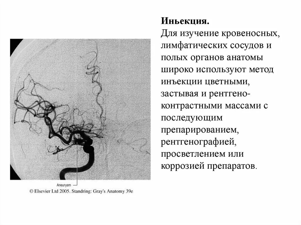 Метод инъекции в анатомии. Инъекционный метод исследования. коррозионные препараты анатомия. методы изучения лимфатических сосудов.