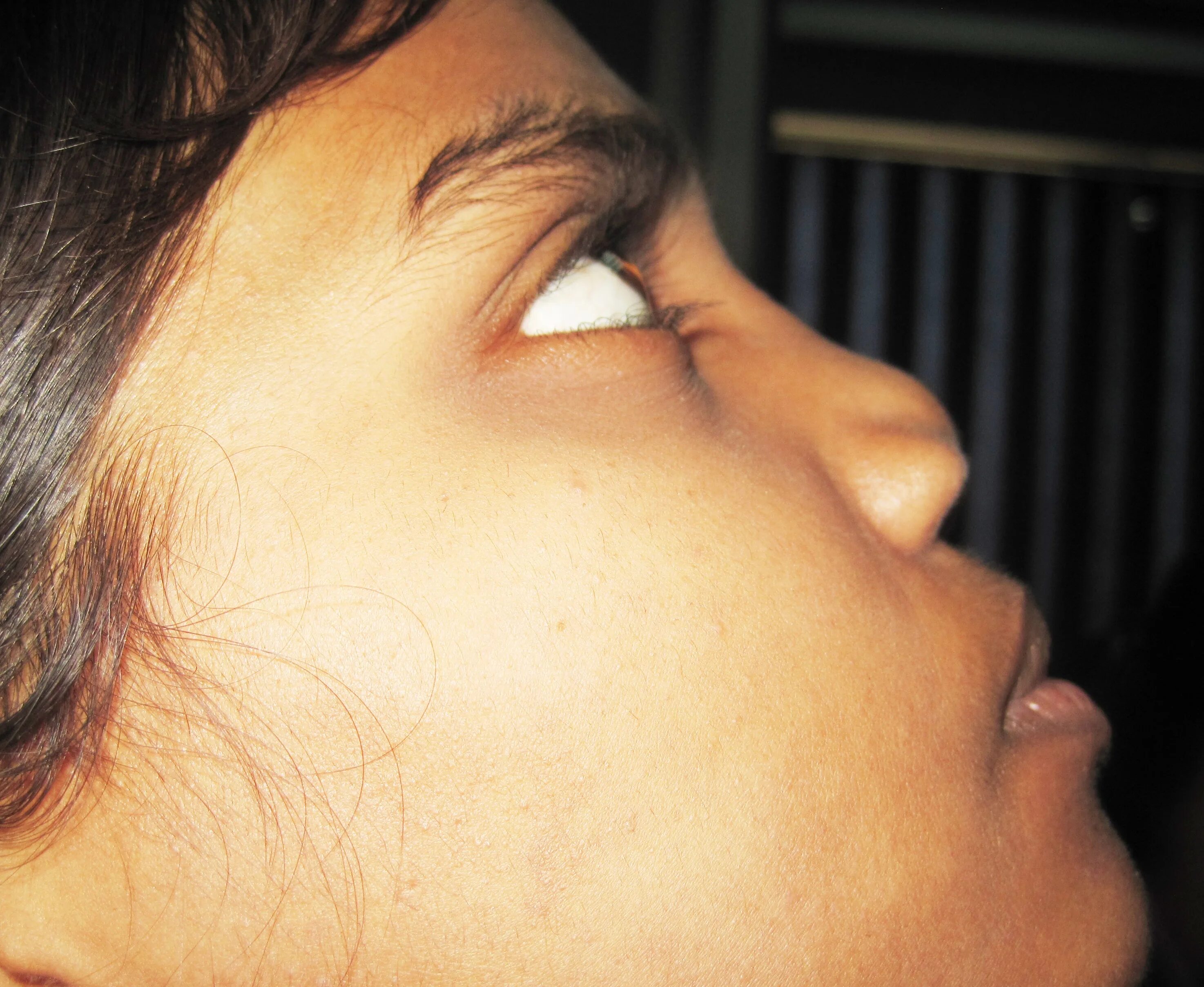 мясистый нос. человек с длинным носом. длинный нос с горбинкой. девушки с большими носами. большой нос в профиль в подростковом возрасте.